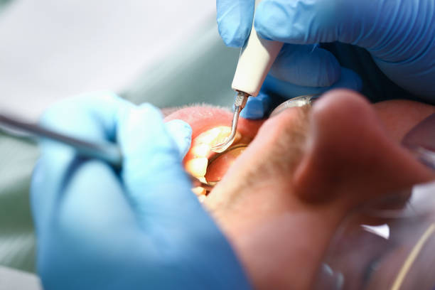 Best Emergency Broken Tooth Repair in East Hazel Crest, IL